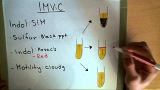 IMViC  Indole  MRVP  Citrate  Microbiology Lab [upl. by Nahamas]