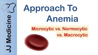 Anemia  Microcytic vs Normocytic vs Macrocytic [upl. by Walling600]