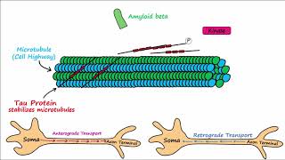 Alzheimers Disease  plaques tangles pathogenesis risk factors disease progression [upl. by Aidnyl]