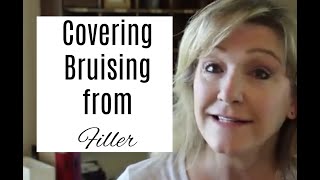 Covering Bruising from Filler OVER 50 [upl. by East]