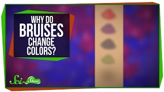 Why Do Bruises Change Colors [upl. by Rednijar]