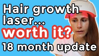 iRestore hair growth laser 18 month update Is it worth it Dr Dray [upl. by Levey391]