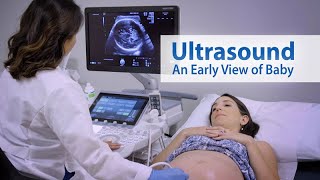 How I do it Ultrasound of the Abdomen [upl. by Monk117]