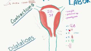 Neurodevelopment of Preterm Babies [upl. by Rola279]