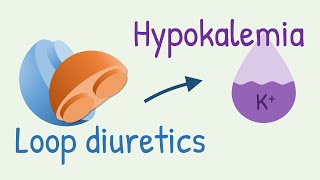 How diuretics cause hypokalemia [upl. by Arhna]