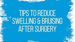 6 Tips To Prevent Bruising from Injections [upl. by Bernat]