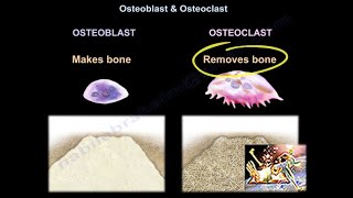 Osteomalacia amp Rickets  Cause Symptom Treatment Diagnosis MedicalSurgical amp Nursing Management [upl. by Ahsiek]