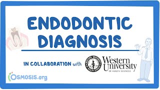 Endodontic Diagnosis in Collaboration w Western University [upl. by Anaihr]