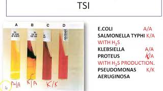 BIOCHEMICAL TEST FOR GRAM NEGATIVE BACILLI part 2 [upl. by Presley]