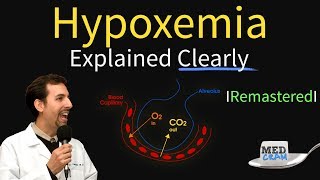 Hypoxemia  The 5 Causes amp Treatment 1 High Altitude [upl. by Amirak202]