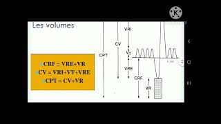 Sémiologie Respiratoire  Syndrome de Condensation [upl. by Ittam]