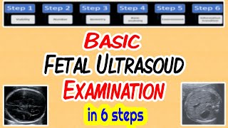 Basic Fetal Ultrasound Examination [upl. by Jodoin]