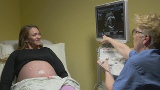 Ultrasounds during pregnancy [upl. by Mharba269]