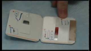 Malaria lab video [upl. by Jacobo]