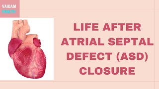 Ventricular Septal Defects by D Bailly  OPENPediatrics [upl. by Nellad]