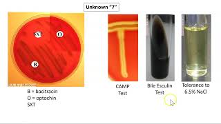 Lancefield Groupings [upl. by Anees]