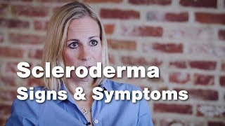 Signs and Symptoms of Scleroderma  Johns Hopkins [upl. by Tiersten262]