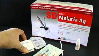 Malaria Antigen Rapid Test [upl. by Blanka]