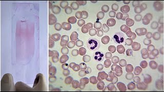 Blood Smear Preparation and Staining Practical Lab [upl. by Sedlik]