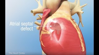 interatrial Septum development [upl. by Peoples]