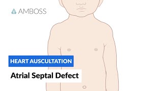 Atrial Septal Defect  Heart Auscultation  Episode 7 [upl. by Annodam]