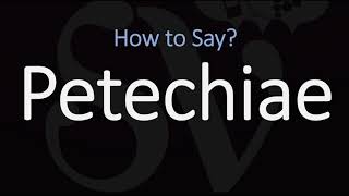 How to Pronounce Petechiae CORRECTLY Meaning amp Pronunciation [upl. by Nnaear957]