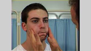 Facial nerve examination  Seventh cranial nerve [upl. by Elvira]