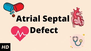 What is Septoplasty and reduction of Inferior Turbinates [upl. by Egni]