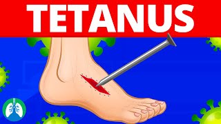 Tetanus Medical Definition  Quick Explainer Video [upl. by Orji825]