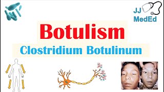 Botulism Clostridium Botulinum Pathogenesis Symptoms Diagnosis Treatment Prevention [upl. by Irihs]