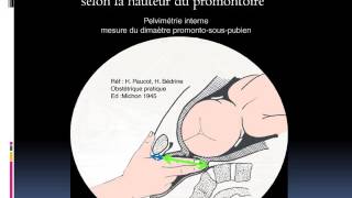 GYNECOLOGIE Examen du bassin obstetrical [upl. by Rici]