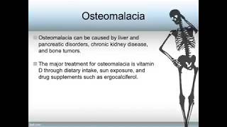 How To Say Osteomalacia [upl. by Pollock668]