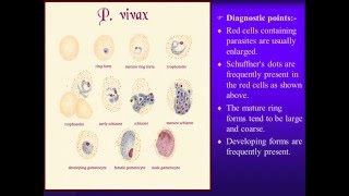 Laboratory diagnosis of malaria parasite [upl. by Pegg]