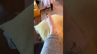 Moving Sprained Ankle [upl. by Leann]