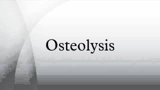 Osteolysis [upl. by Damal]