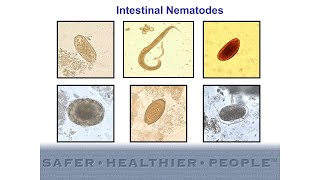 Diagnostic Features of Intestinal Nematodes [upl. by Lawan]