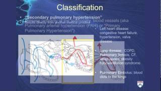 1 Cause of Hypertension – Hyperinsulinemia and High Insulin Levels – DrBerg [upl. by Reggis887]