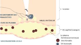 Œdème Aigue Du Poumon [upl. by Nireil]