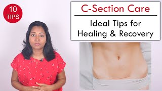 10 Tips to help Heal C Section wound  Post Delivery Care [upl. by Huei]