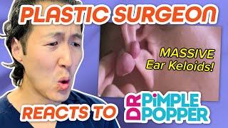 Plastic Surgeon Reacts to DR PIMPLE POPPER Massive Keloids on the Ears [upl. by Nojad]