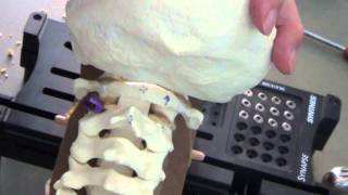 APSS Workshop Video 6 Posterior C1C2 Fixation and Lateral Mass Fixation [upl. by Lunt]