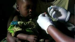 Rapid Diagnostic Test RDT for Malaria [upl. by Adnocahs16]