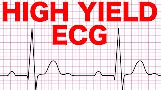 Electrocardiograms ECG Made Easy [upl. by Manheim96]