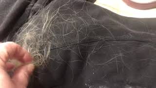 Waxy Film on Skin Hair Loss Horsehair Nematomorpha Human Parasite Symptoms 120 [upl. by Airtal469]