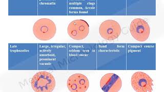 Laboratory diagnosis of Malaria lecture [upl. by Patt937]