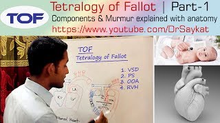 Fetal echocardiography at 1113 weeks Tetralogy of Fallot TOF [upl. by Purpura69]