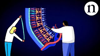 Retinal repair Bringing stem cells into focus [upl. by Wallas]