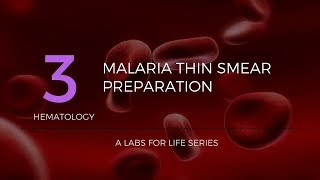 Malaria Thin Smear Preparation [upl. by Kassia]