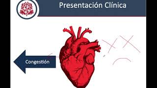 Insuficiencia Respiratoria Aguda  Parte 1 Fisiopatología [upl. by Gaultiero]