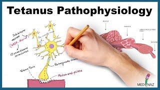 Tetanus Pathophysiology Mechanism of Action [upl. by Kliman]